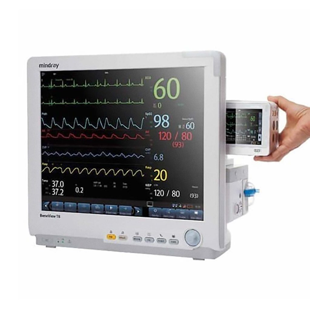 A display showing different patient data