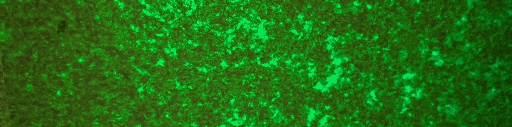Speckle pattern